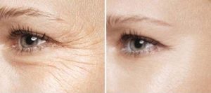 Prima e dopo con Instantly Ageless di Jeunesse