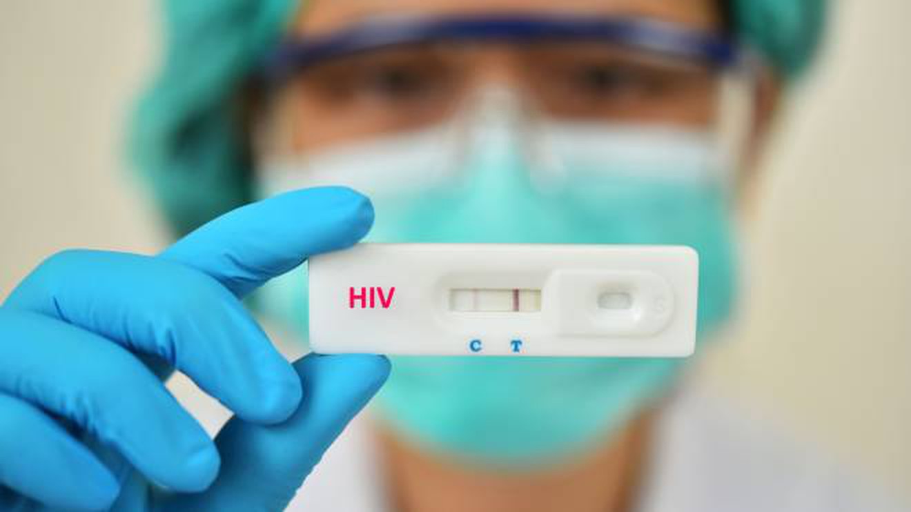 HIV 1