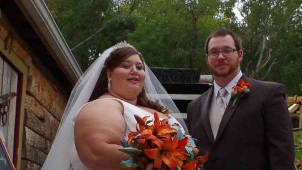 coppia di obesi perde 180 kg