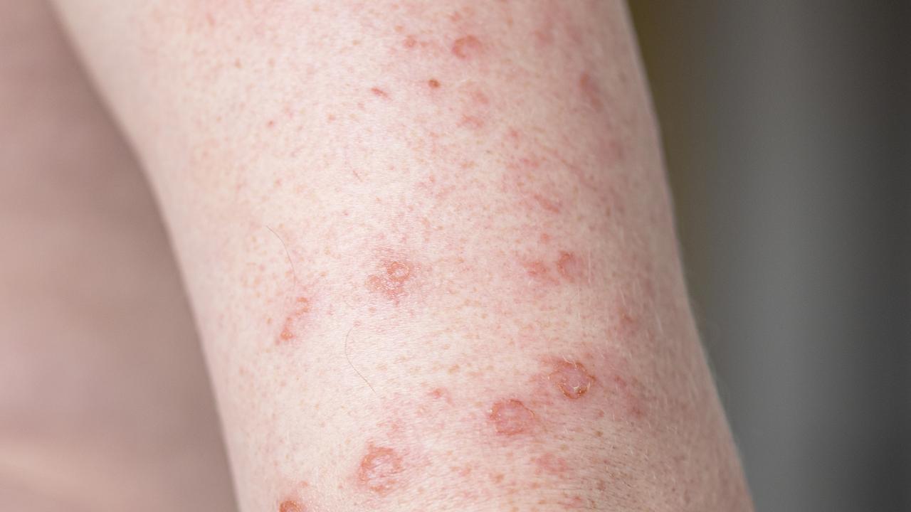 Influenza del pomodoro.