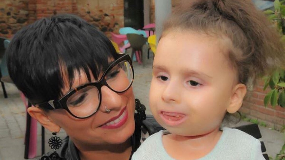 Scoperta la causa della malattia che aveva colpito Bea, la "bambina di pietra"