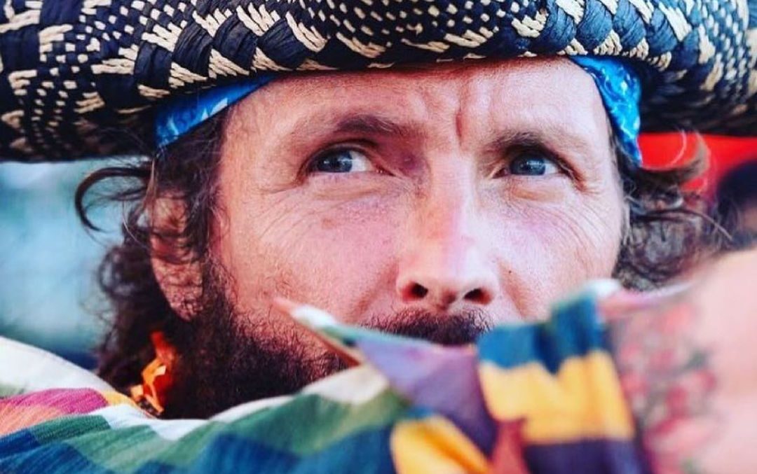 Jovanotti come sta dopo l'incidente