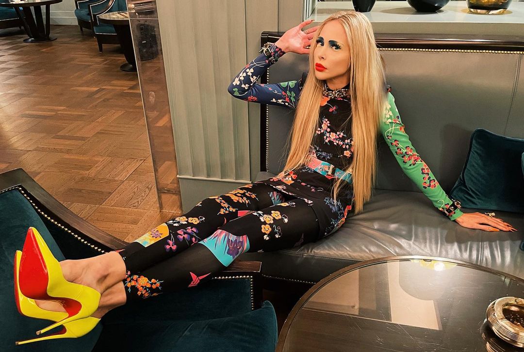 Spende 150mila euro per allungare le gambe e accontentare il marito: "Gli piacevano le donne alte"