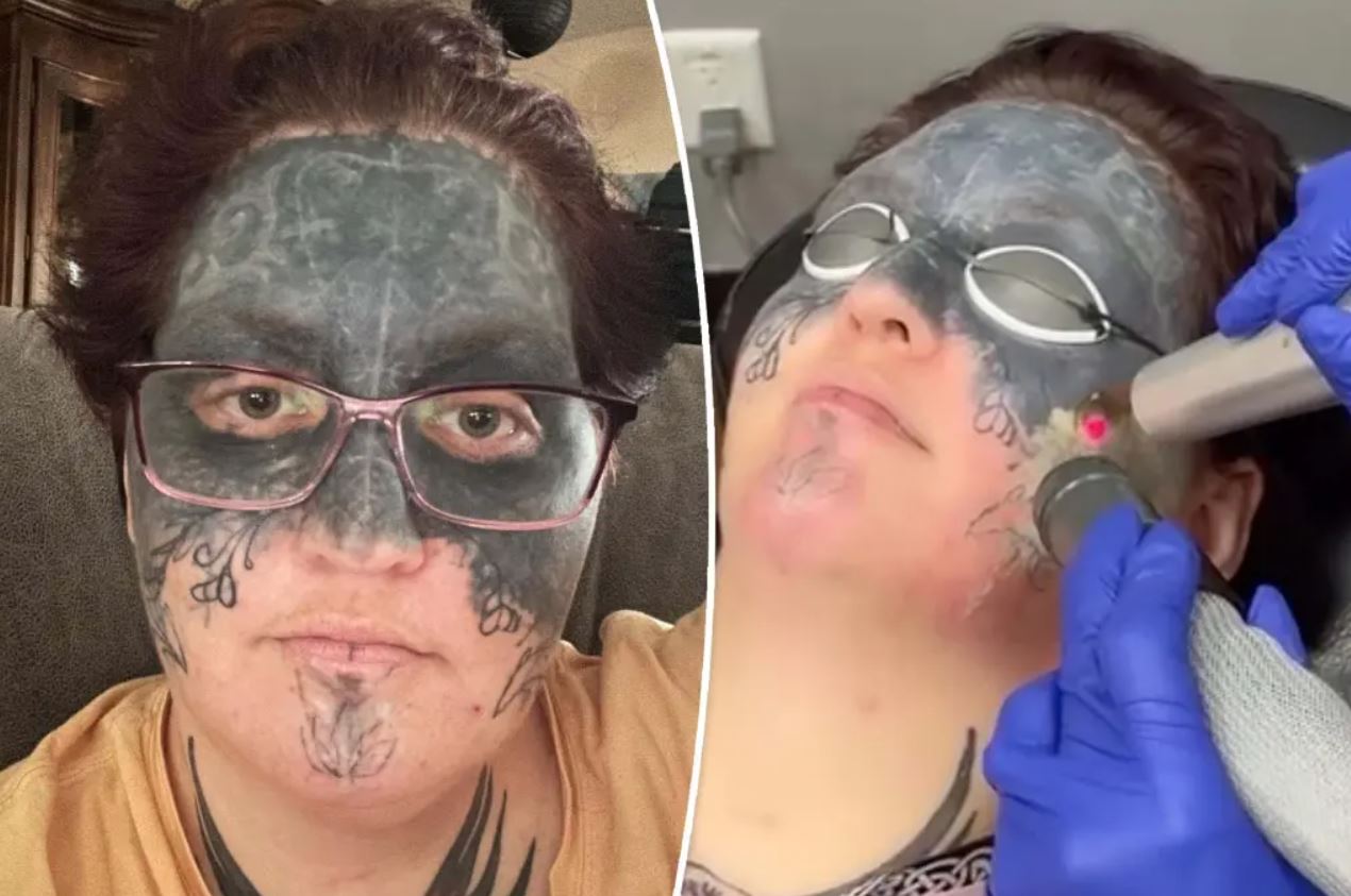 Costretta tatuarsi sul volto, non trova lavoro: sconosciuto si offre di pagare la rimozione
