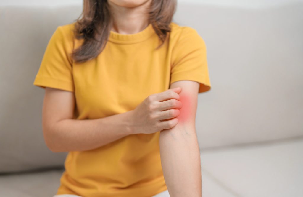 Lebbra Europa_Donnaclick