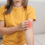 Lebbra Europa_Donnaclick