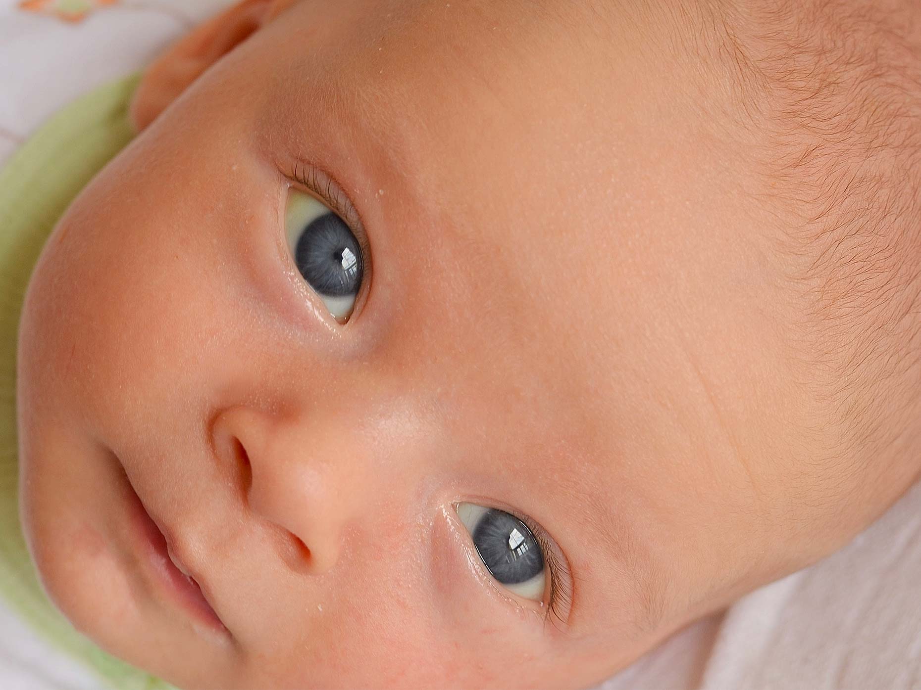 Cos L ittero Neonatale Cause Sintomi E Cura