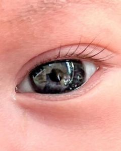 L'occhio del terzo figlio di Adriana Lima.