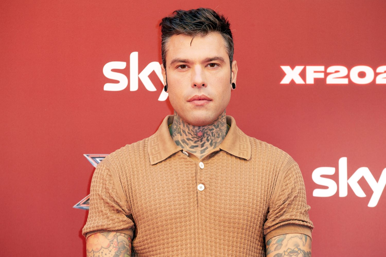 Cosa sono le stimolazioni transcraniche a cui si sta sottoponendo Fedez?